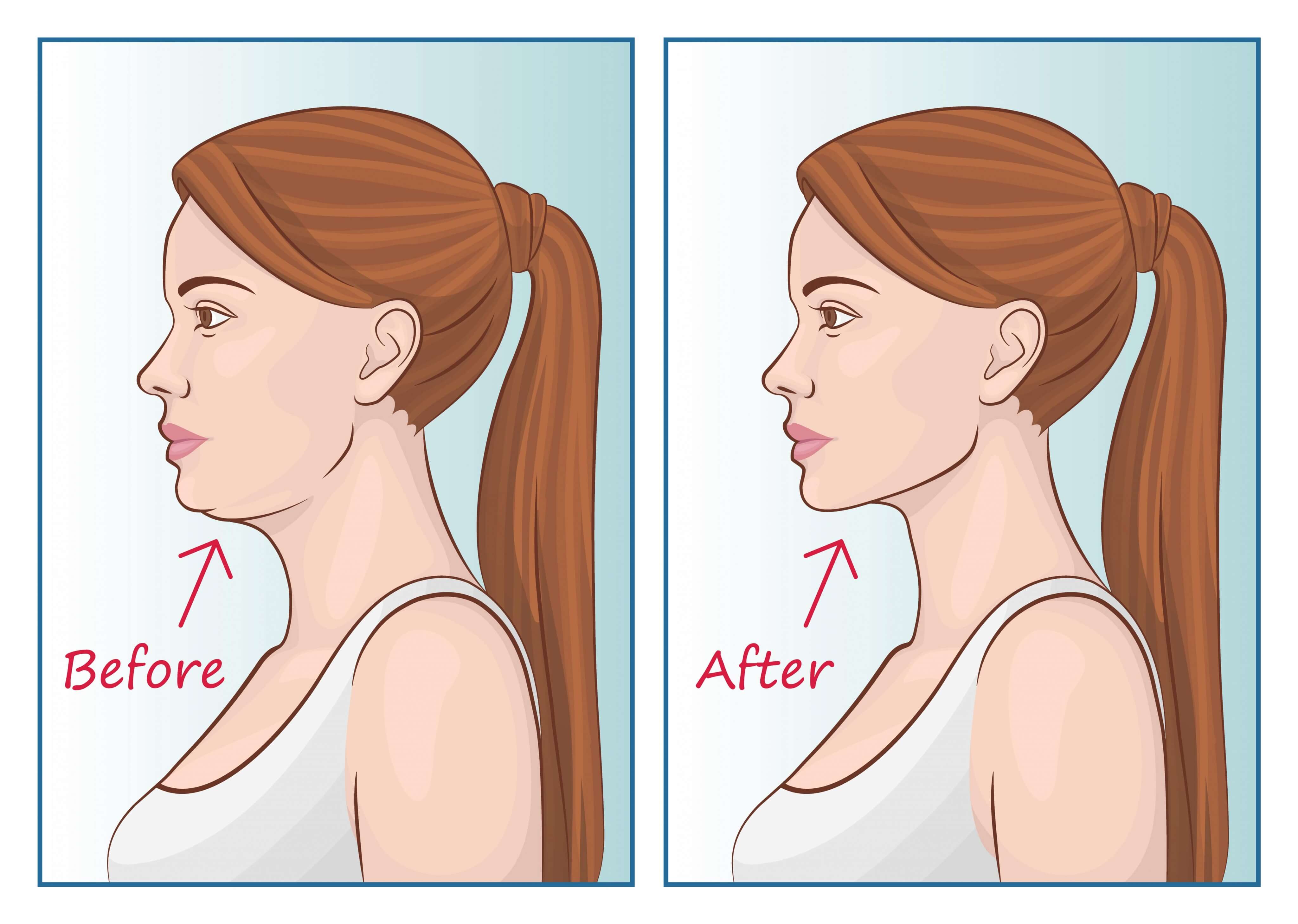 Mewing: the viral technique for jaw definition - HIGHXTAR.