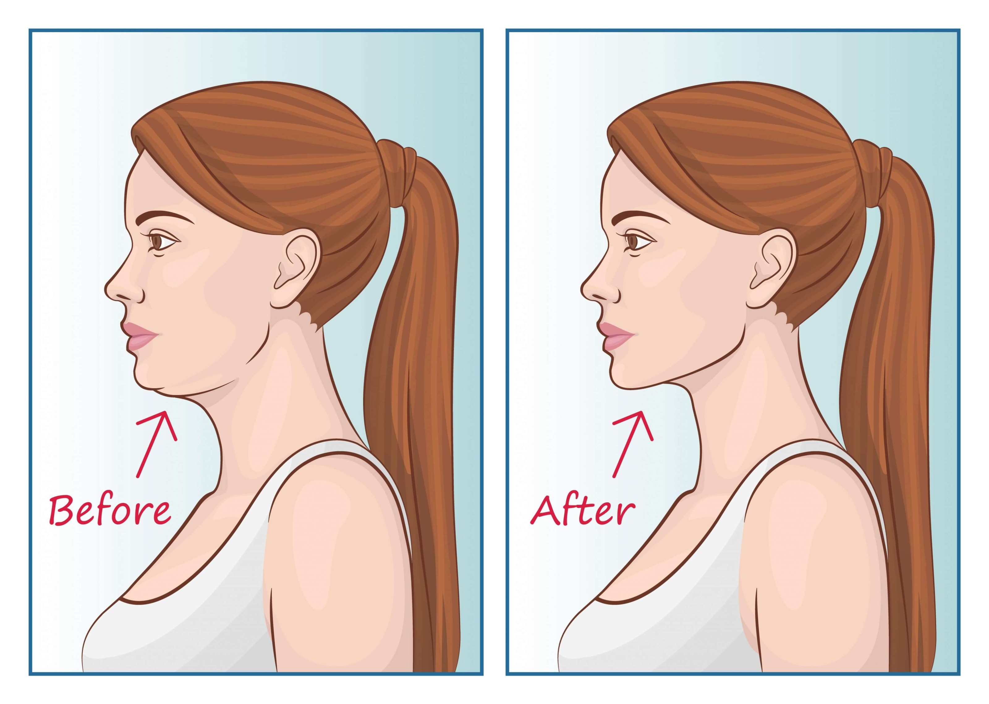 Eric davis dental mewing what is mewing and does it work 