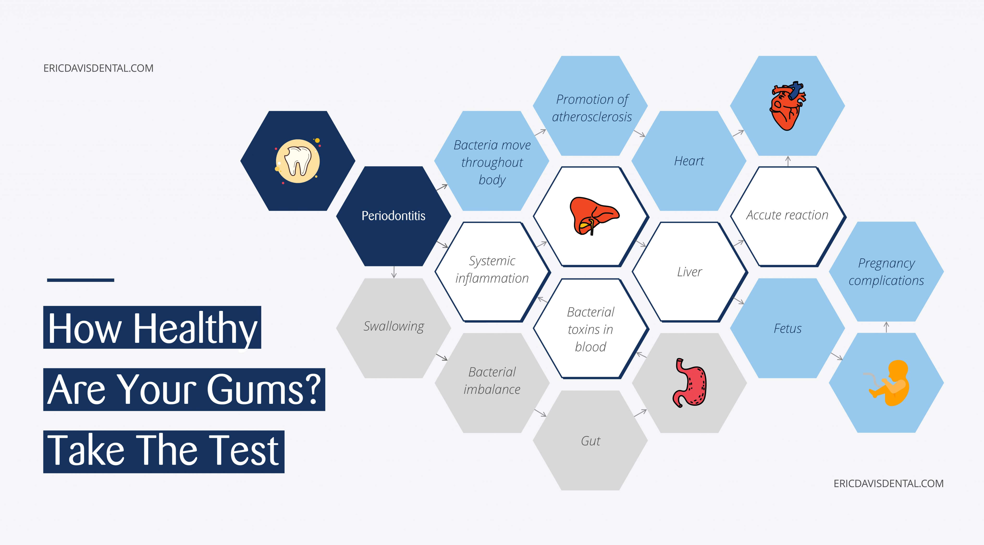 Eric Davis Dental gum disease test and treatment