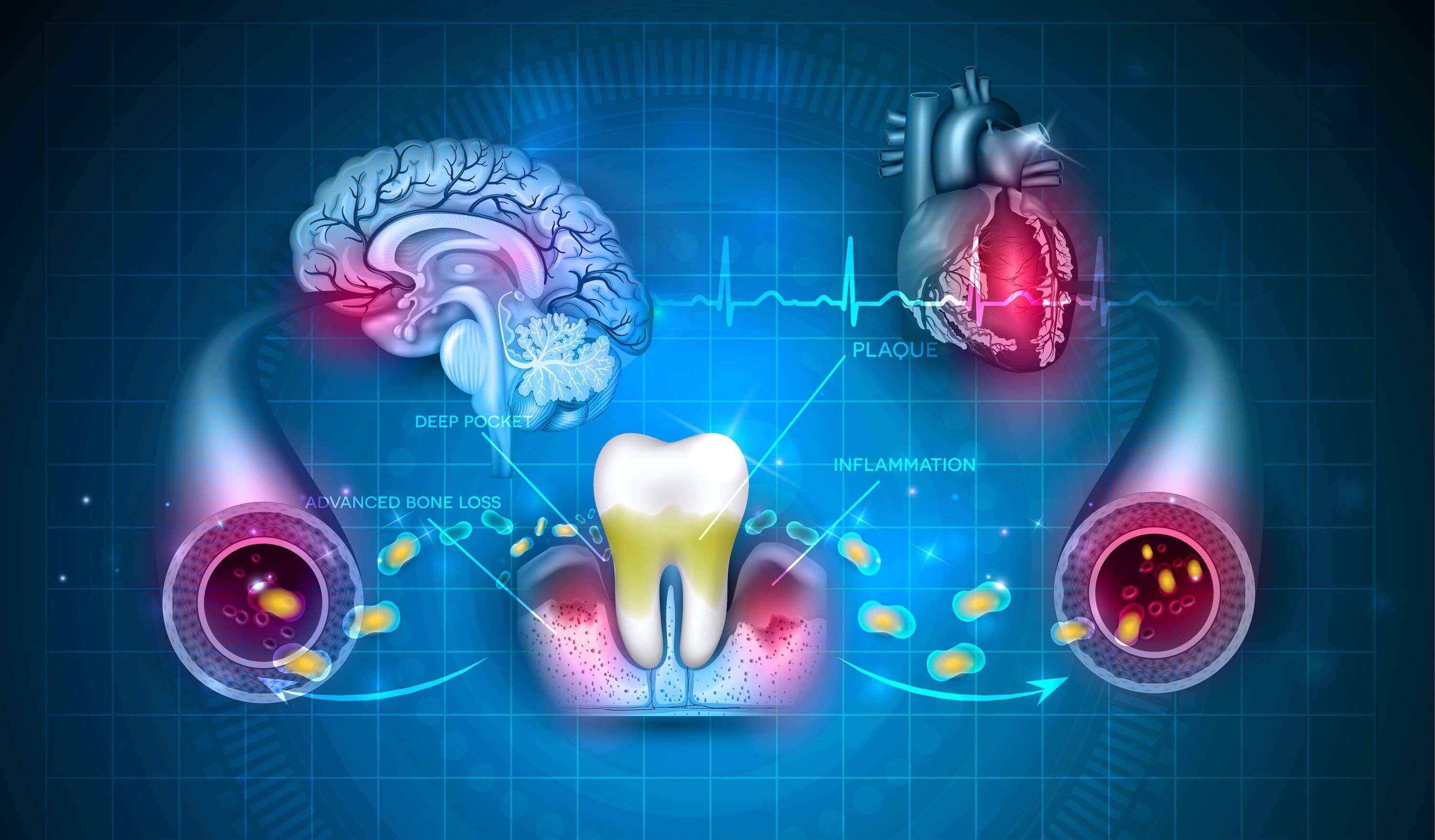 Disease Starts in the Mouth