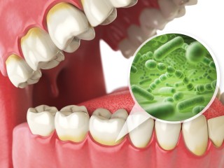 Gum Disease and The Bugs That Cause It