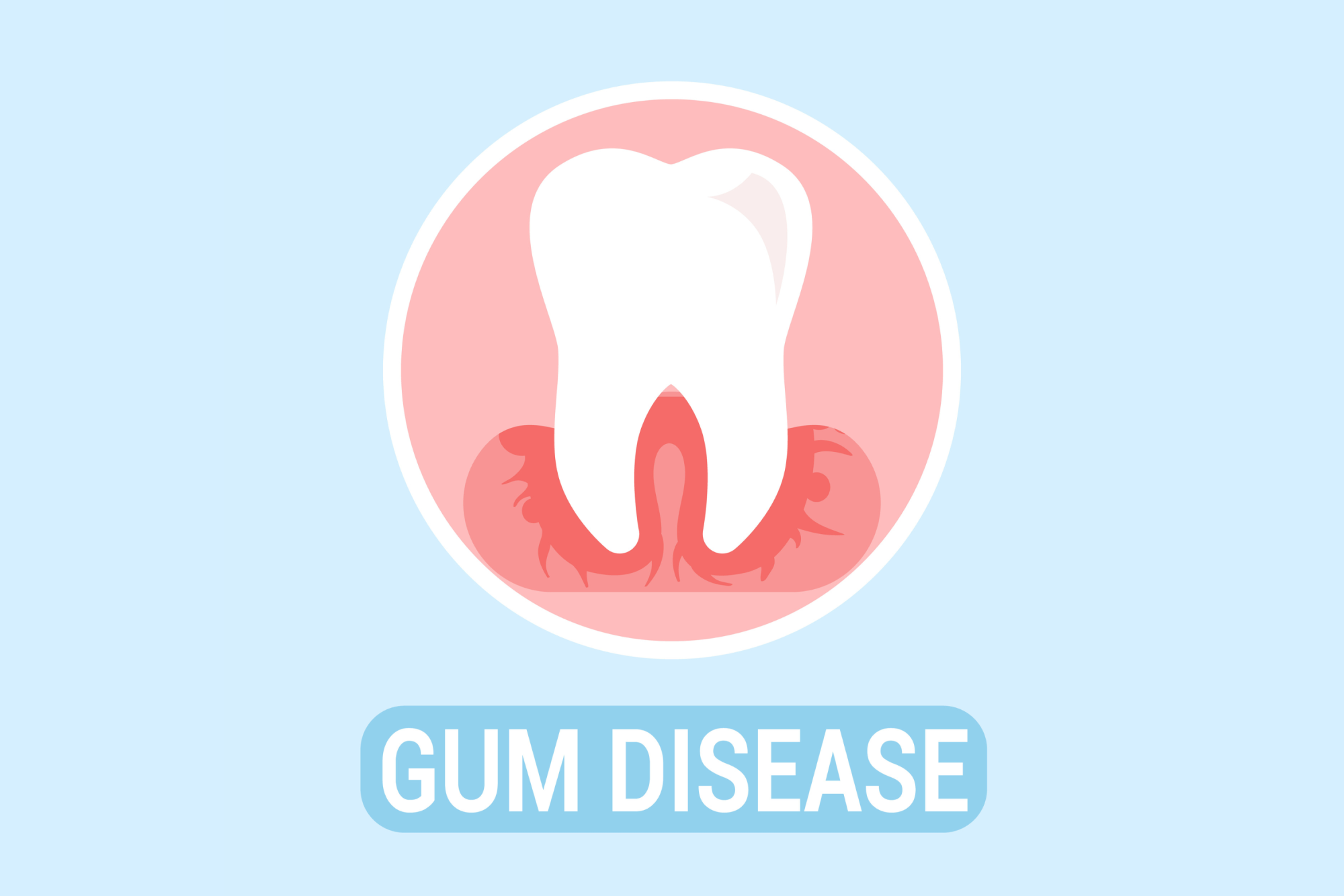 Periodontal Disease Treatment — A More Effective Way to Treat Gum Disease