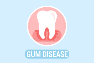 Periodontal Disease Treatment — A More Effective Way to Treat Gum Disease