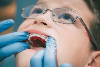 The Differences Between Orthotropics and Orthodontics